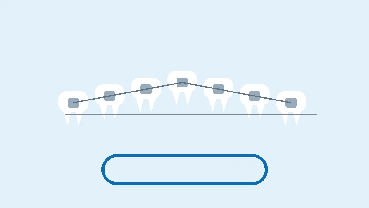 Ilustración de una arcada dental con brackets y un alineador transparente